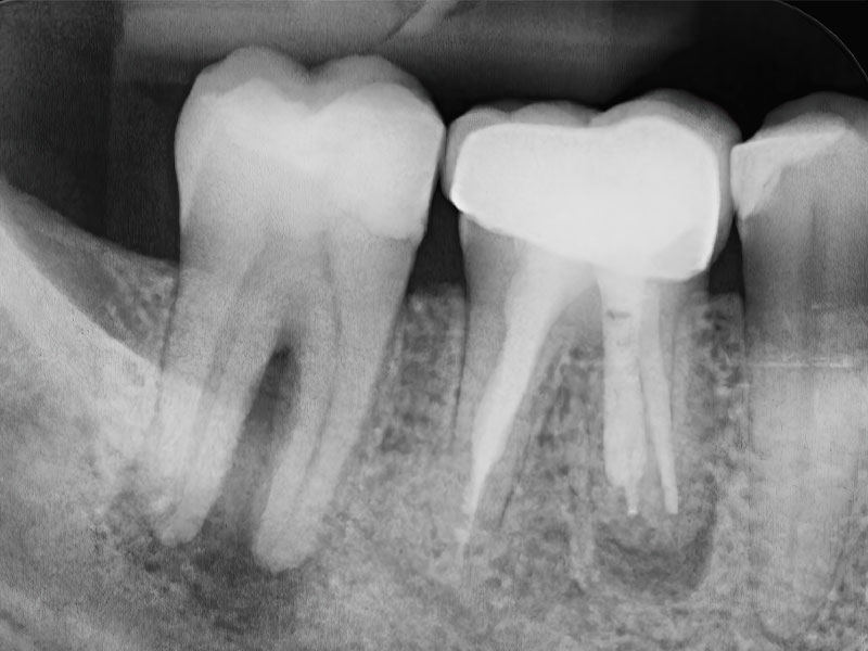 Endodonzia