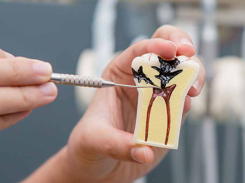 Endodonzia