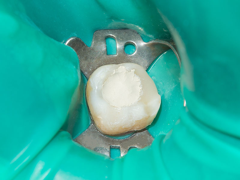 Endodonzia