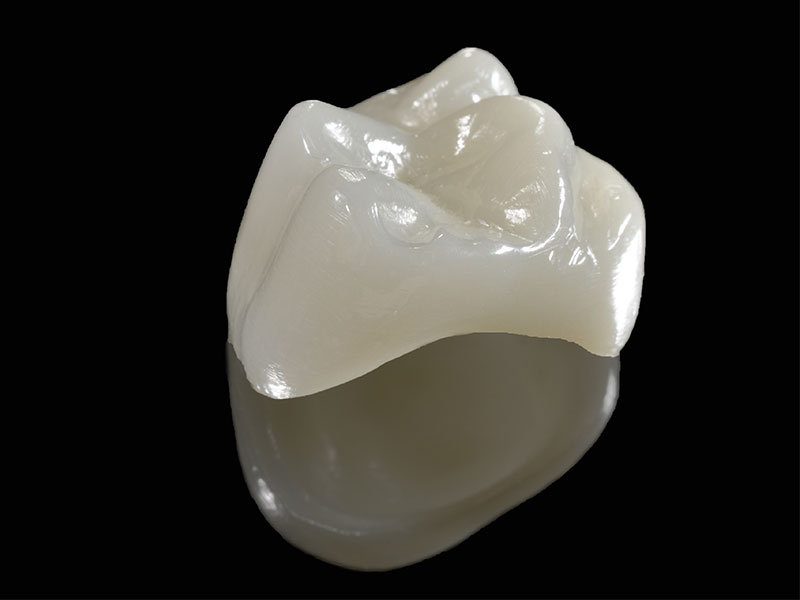 Endodonzia